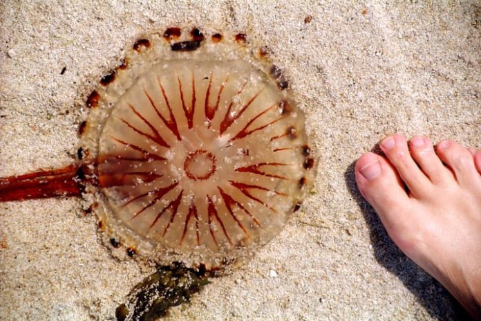puntura di medusa come comportarsi sintomi conseguenze e rimedi
