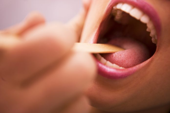 Mal di gola (faringite): che cos’è, sintomi, cause e possibili cure