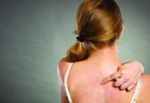 Dermatite Atopica: che cos'è, sintomi, cause e come diagnosticarla