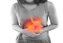 Acidità di stomaco: che cos'è, sintomi, diagnosi e possibile cure
