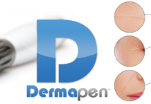DermaPen penna per trattamento Needling: che cos'è, a cosa serve, come funziona e dove praticarlo