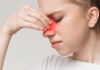 Congestione Nasale: che cos'è, cause, sintomi, diagnosi e possibili cure