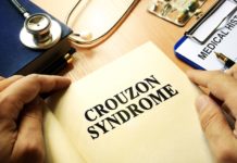 Sindrome di Crouzon: che cos’è, sintomi, diagnosi, cause e possibili cure