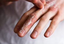Ragadi alle dita delle mani: cosa sono, sintomi, cause e possibili cure