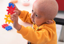 Progeria: che cos’è, sintomi, cause, diagnosi e possibili cure