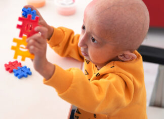 Progeria: che cos’è, sintomi, cause, diagnosi e possibili cure
