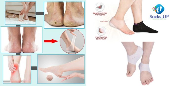 Socks Up: Plantare curativo per ridurre i dolori articolari, funziona davvero? Recensioni, opinioni e dove comprarlo