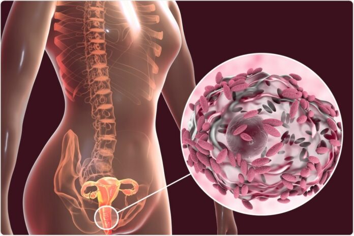 Vaginosi Batterica : che cos’è, sintomi, cause, diagnosi e possibili cure