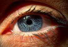 Distacco di retina: che cos'è, cause, sintomi, diagnosi e possibili cure