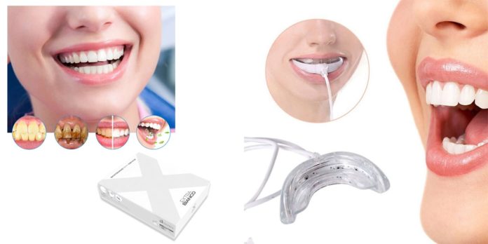 Extra Bianco: Kit Sbianca Denti, funziona davvero? Recensioni, opinioni e dove comprarlo